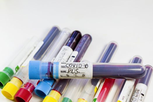 Corona virus and Covid-19 positive blood test tubes on the white background, studio shoot. Blood test samples. Diagnosis and laboratory.