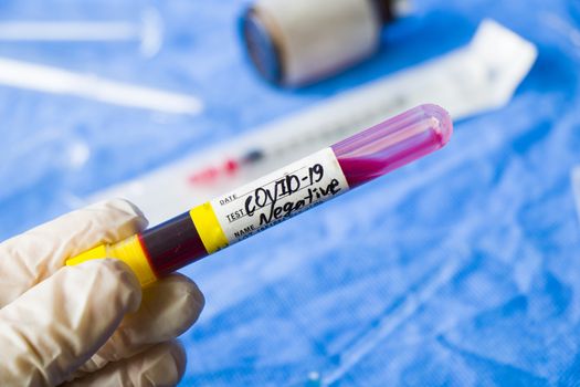 Corona virus negative blood test tubes on the white background, studio shoot. Blood test samples. Diagnosis and laboratory.