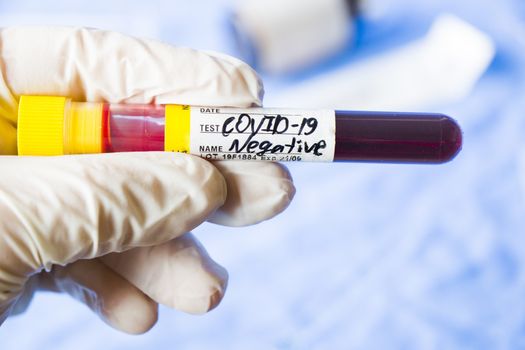 Corona virus negative blood test tubes on the white background, studio shoot. Blood test samples. Diagnosis and laboratory.