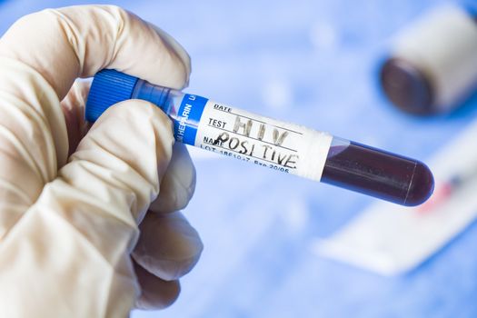 Hiv and aids infection test, hand holding tube with blood on the blue background. Studio shoot.