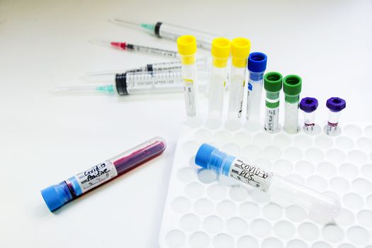 Corona virus and Covid-19 positive blood test tubes on the white background, studio shoot. Blood test samples. Diagnosis and laboratory.