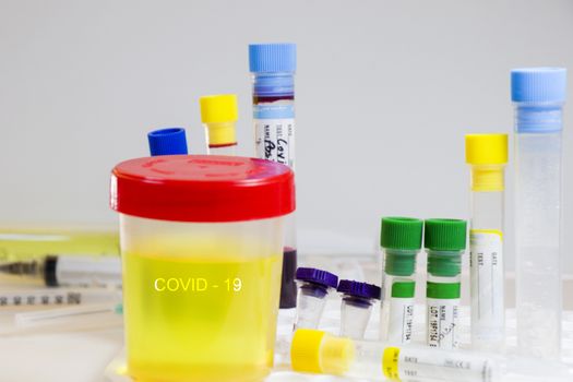 Covid-19 and coronavirus test, medical urine and pee test with blood and other tubes on the white background, colorful lab test containers, research and analysis of NCOV viruses, laboratory tests studio shoot