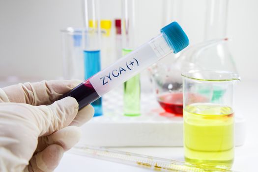 Zyca virus, blood test tube samples
