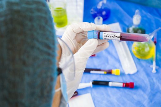 Creatinine blood test tube sample in doctors hand in laboratory, doctors face