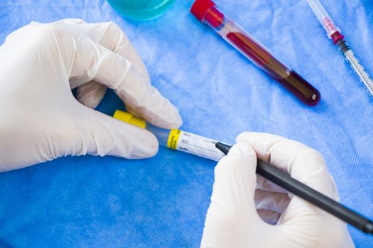 Doctor in laboratory with uniform write text on the blood tube sample, white glove