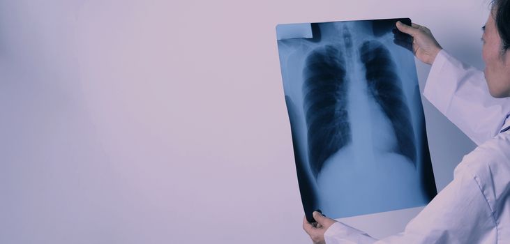 Middle aged of asian woman doctor standing and holding a x-ray film or radiography. she looking for unnormal or disease on lungs which illness from coronavirus pandemic