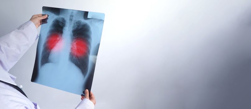 Middle aged of asian woman doctor standing and holding a x-ray film or radiography. she looking for unnormal or disease on lungs which illness from coronavirus pandemic