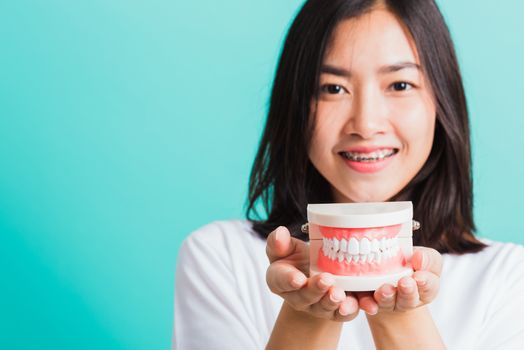 Portrait of Asian teen beautiful young woman smile have dental braces on teeth laughing she holding medical equipment dental model teeth, isolated on a blue background, Medicine and dentistry concept