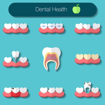 Dental care flat design Vector illustration of heathy theeth, caries, braces system, implantation, and other dental health icons set