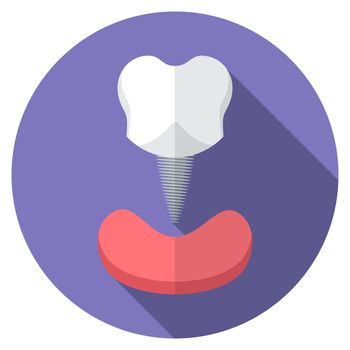 Flat design modern vector illustration of tooth implant icon with long shadow, isolated