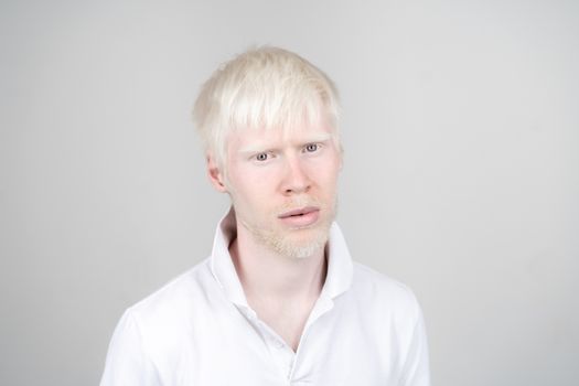 albinism albino man in studio dressed t-shirt isolated on a white background. abnormal deviations. unusual appearance. skin abnormality