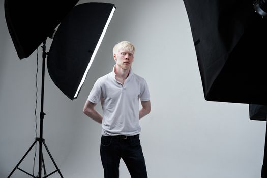 albinism albino man white skin hair studio dressed t-shirt standing flash light. abnormal deviations. unusual appearance. skin abnormality Beautiful people with special appearance.
