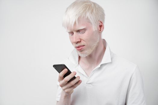 albinism albino man white skin hair studio dressed t-shirt isolated white background abnormal deviations unusual appearance abnormality Beautiful people Talking on the phone.