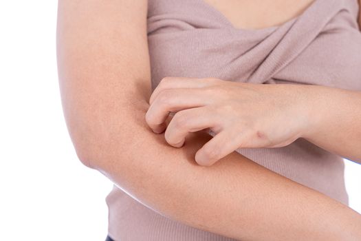 Female scratching her arm isolated white background. Medical, healthcare for advertising concept.