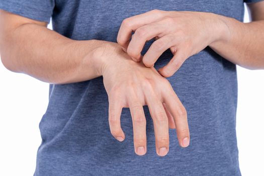 Male scratching his hand isolated white background. Medical, healthcare for advertising concept.