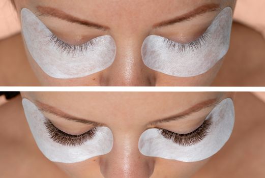 Treatment of Eyelashes Extensions. Comparison of Eyelash Extension before and after