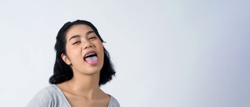 Asian teen facial with braces and smiling to camera to show dental orthodonic teeth which include professional metal wire material from orthodontist. studio shot white background.