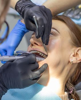 Beautiful woman in dental chair during procedure of installing braces to upper and lower teeth. Dentist and assistant working together, dental tools in their hands. Top view. Concept of dentistry
