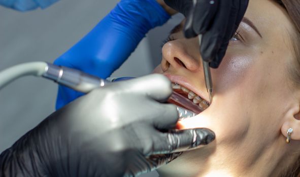 Beautiful woman in dental chair during procedure of installing braces to upper and lower teeth. Dentist and assistant working together, dental tools in their hands. Top view. Concept of dentistry