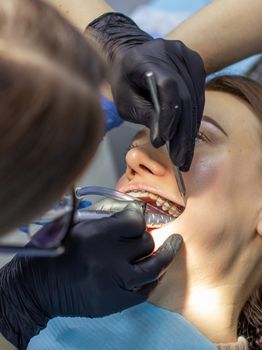 Beautiful woman in dental chair during procedure of installing braces to upper and lower teeth. Dentist and assistant working together, dental tools in their hands. Top view. Concept of dentistry