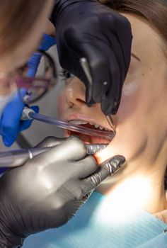 Beautiful woman in dental chair during procedure of installing braces to upper and lower teeth. Dentist and assistant working together, dental tools in their hands. Top view. Concept of dentistry