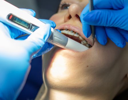 A woman with dental braces visits an orthodontist at the clinic. in the dental chair during the procedure of installing braces on the upper and lower teeth. Dentist and assistant work together, they have dental instruments in their hands. concept of dentistry