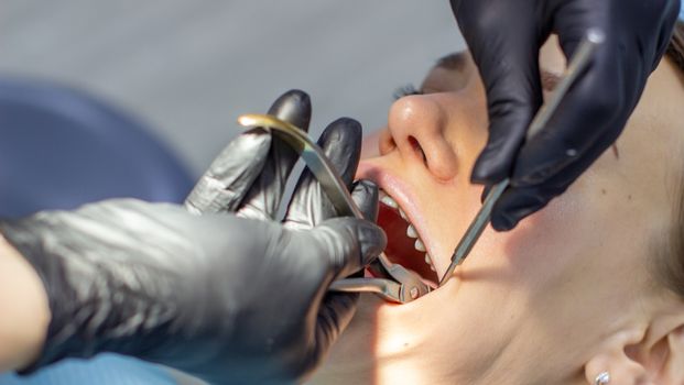 Beautiful woman in dental chair during procedure of installing braces to upper and lower teeth. Dentist and assistant working together, dental tools in their hands. Top view. Concept of dentistry