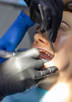 Beautiful woman in dental chair during procedure of installing braces to upper and lower teeth. Dentist and assistant working together, dental tools in their hands. Top view. Concept of dentistry