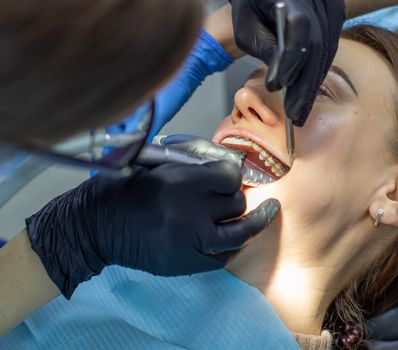 Beautiful woman in dental chair during procedure of installing braces to upper and lower teeth. Dentist and assistant working together, dental tools in their hands. Top view. Concept of dentistry