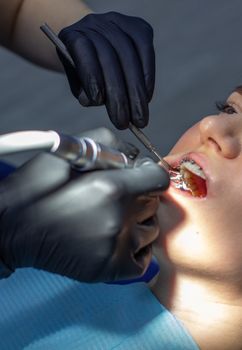 A woman with dental braces visits an orthodontist at the clinic. in the dental chair during the procedure of installing braces on the upper and lower teeth. Dentist and assistant work together, they have dental instruments in their hands. concept of dentistry