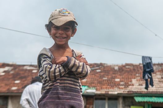 5/16/2018. Lomnicka, Slovakia. Roma community in the heart of Slovakia, living in horrible conditions. Portrait of child.