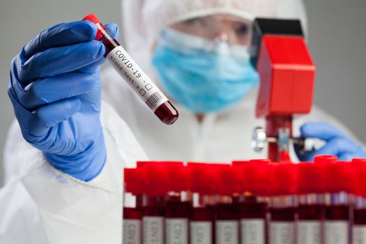 Medical technologist or lab scientist microscope examining Coronavirus patient test tube blood sample specimen, deadly COVID-19 respiratory virus disease global worldwide pandemic outbreak crisis