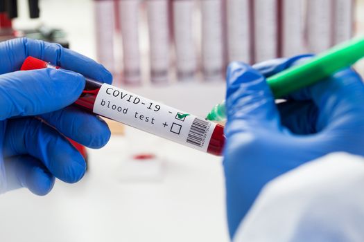 Lab scientist medical technologist labelling blood sample test tube vacutainer,NEGATIVE result,COVID-19 virus disease, deadly contagious Coronavirus global pandemic outbreak,world health organization