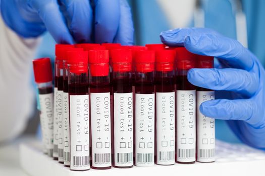 Lab scientist or medical technician examining COVID-19 coronavirus patient blood samples,test tube vacutainers ready for analysis,polymerase chain reaction (rRT-PCR) test for detection of SARS-CoV-2