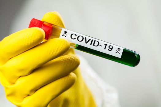 Lab scientist or medical technologist holding test tube with Coronavirus COVID-19 toxic green liquid, science fiction illustration of deadly corona virus, global pandemic crisis outbreak, cure vaccine