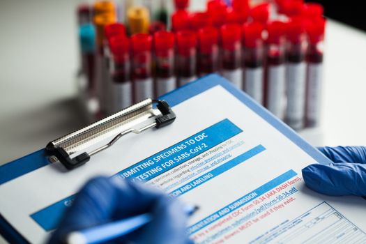 Lab technician filling out specimen submitting form,laboratory testing for SARS-CoV-2 novel corona virus disease,closeup of hands in gloves holding pen and medical file with blood sample in background
