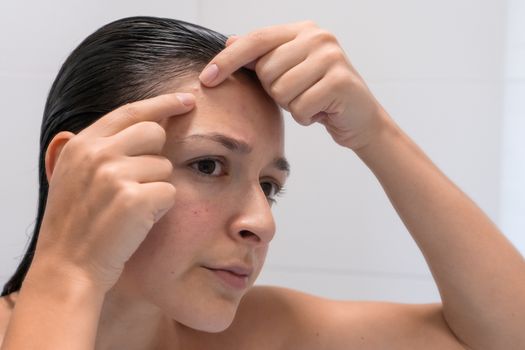 Close-up portrait of a girl squeezes out a pimple on her forehead. An awkward moment before a date.