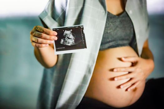 pregnant woman closeup of belly