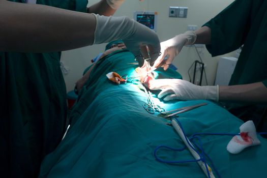 Midsection of surgery team operating Medical Team Performing Surgical Operation in Modern Operating Room
or Group of surgeons in operating room with surgery equipment.