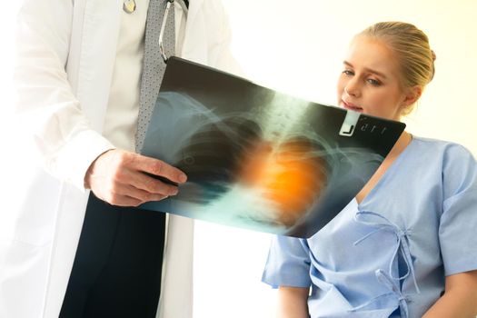 Doctor explaining lungs x-ray to women patient in clinic or Doctor in the office examining an x-ray and discussing with a patient