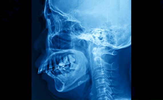 Film x-ray skull and cervical spine lateral view, X-Ray film of human bones from nose to chest.