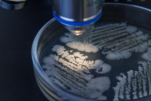 Close-up of a colony of bacteria against a background of a microscope. Laboratory microscope and petri dish with bacteria. Analysis of bacterial culture under a microscope. Zoom bacteria.