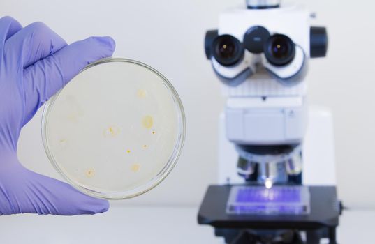 A Petri dish with colored bacteria on the background of the microscope. Bacterial analysis in the laboratory.