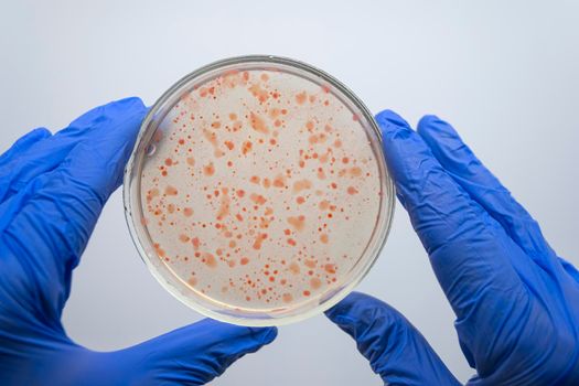Close-up of two gloved hands of a scientist holding a petri dish with red bacteria.