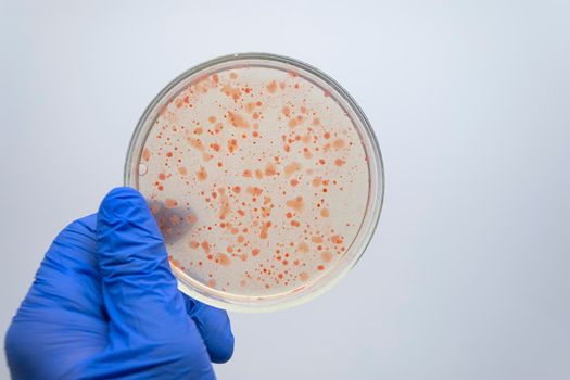 Scientists are studying the microbiota of the intestines and stomach of a person on a Petri dish, close-up.