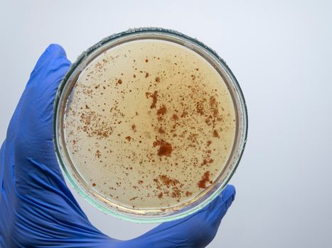 Red bacteria on yellow nutrient medium in a petri dish the scientist holds in his hand.
