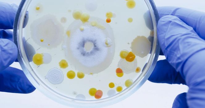 Close-up of bacteria on a petri dish held by a scientist in blue gloves. Among the color colonies of bacteria, a large white mold has grown.
