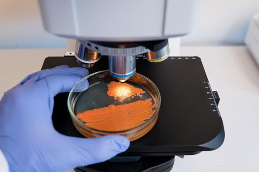 Close-up doctor puts a petri dish with orange bacteria under the microscope for the analysis. Examine bacteria on a petri dish under the microscope.