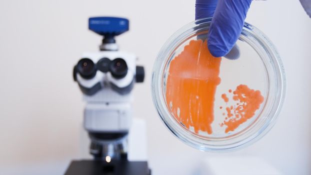 Analysis of bacterial colonies under a microscope. Orange bacteria in a Petri dish on the background of a large microscope.