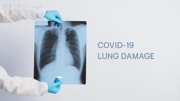 Xray film of Covid 19 lung damage and holding by doctor hand in medical glove and PPE or Personal Protection Equipment suit. Studio shot white background. Coronavirus pandemic and Healthcare medical concept.